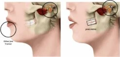 Kaaklijn Jawline Trainer Sport Fitness Kaak Trainer Gym Jawliner - Variant Expert - Kaaklijn Onderkin Gezichtstrainer - Jawliner® -Merkloos Winkel 1200x572 2