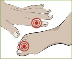 Vital Comfort Vinger- En Teenbeschermers, Elk 2 -Merkloos Winkel 1200x987 9