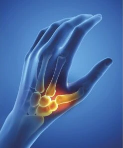 Epitact Flexibele Duimbrace Links Maat L 1ST -Merkloos Winkel 997x1200 12